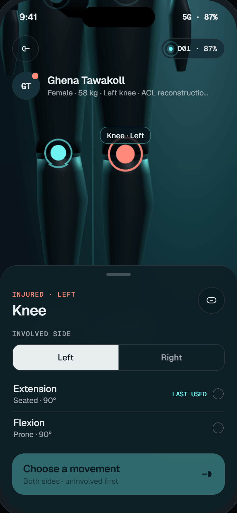 Choose joint screen